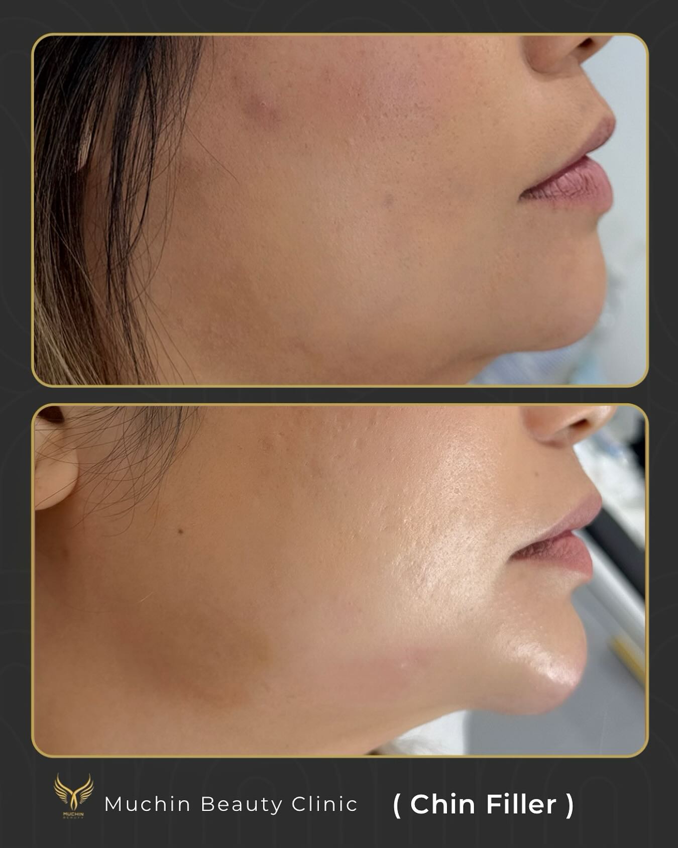 Before & After