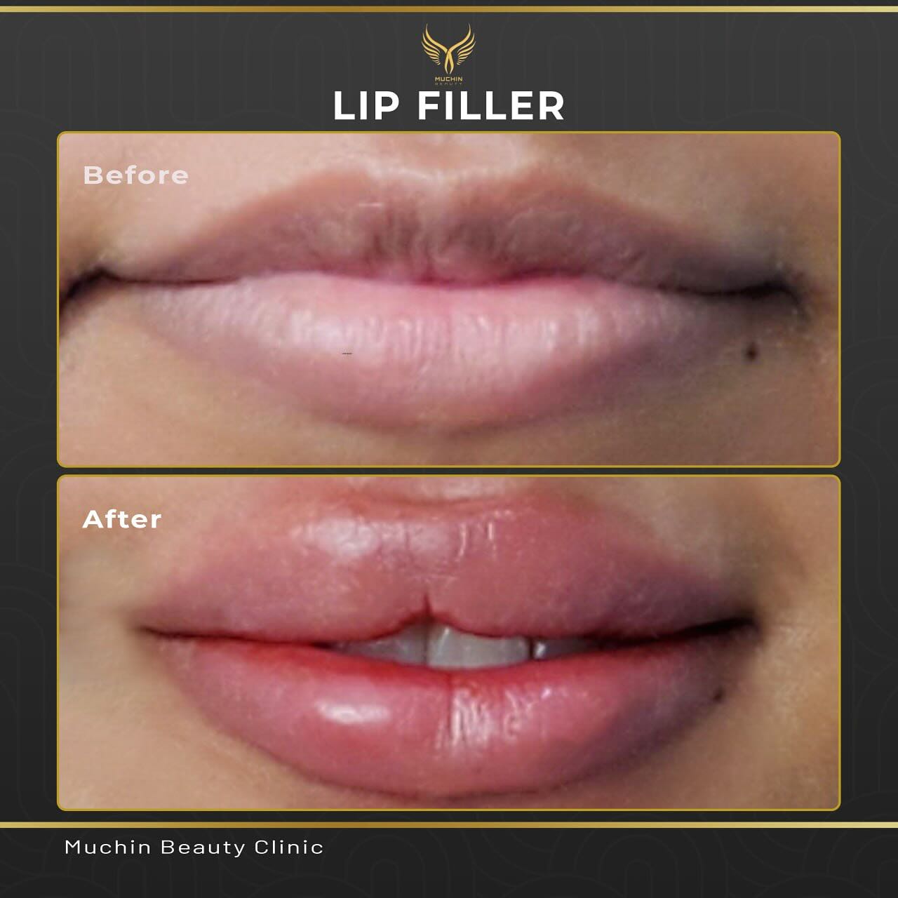 Before & After