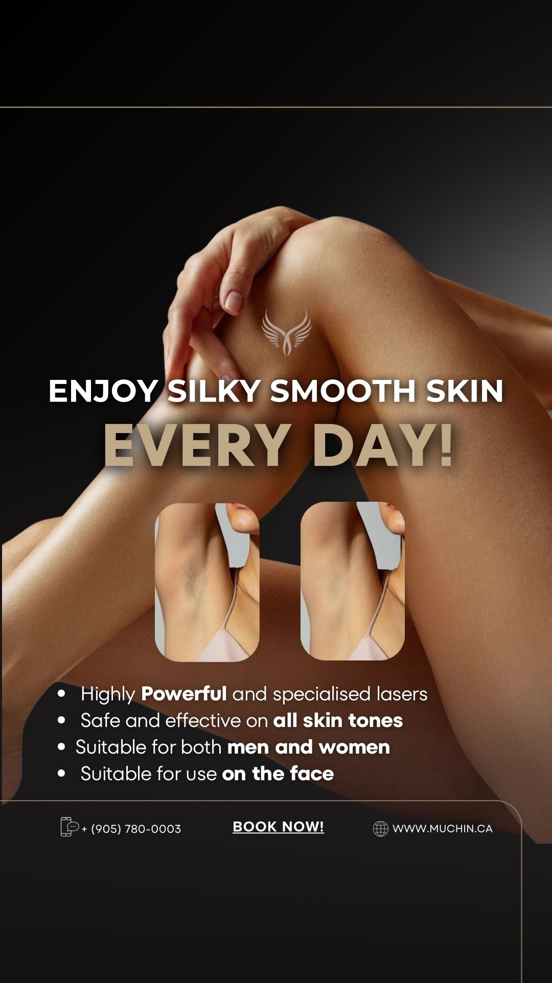 Muchin Beauty — Laser Hair Removal