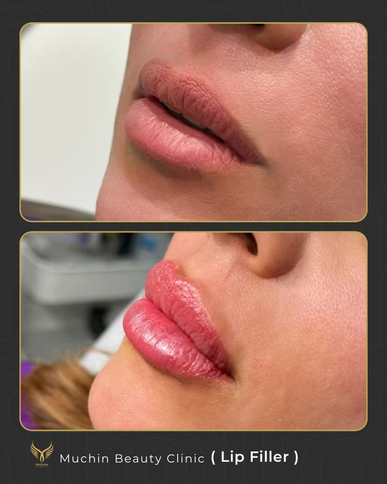 Before & After