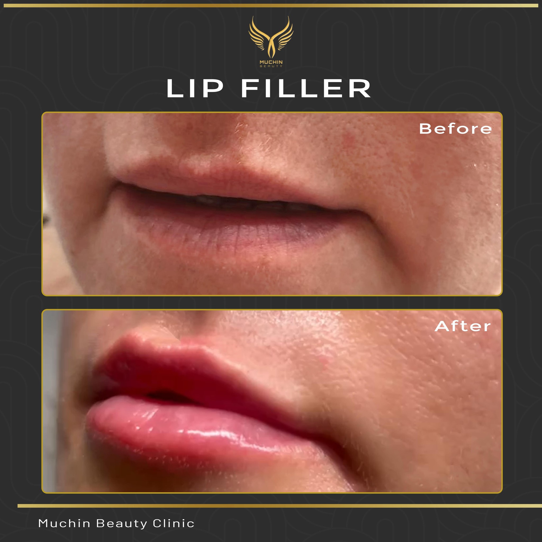 Before & After