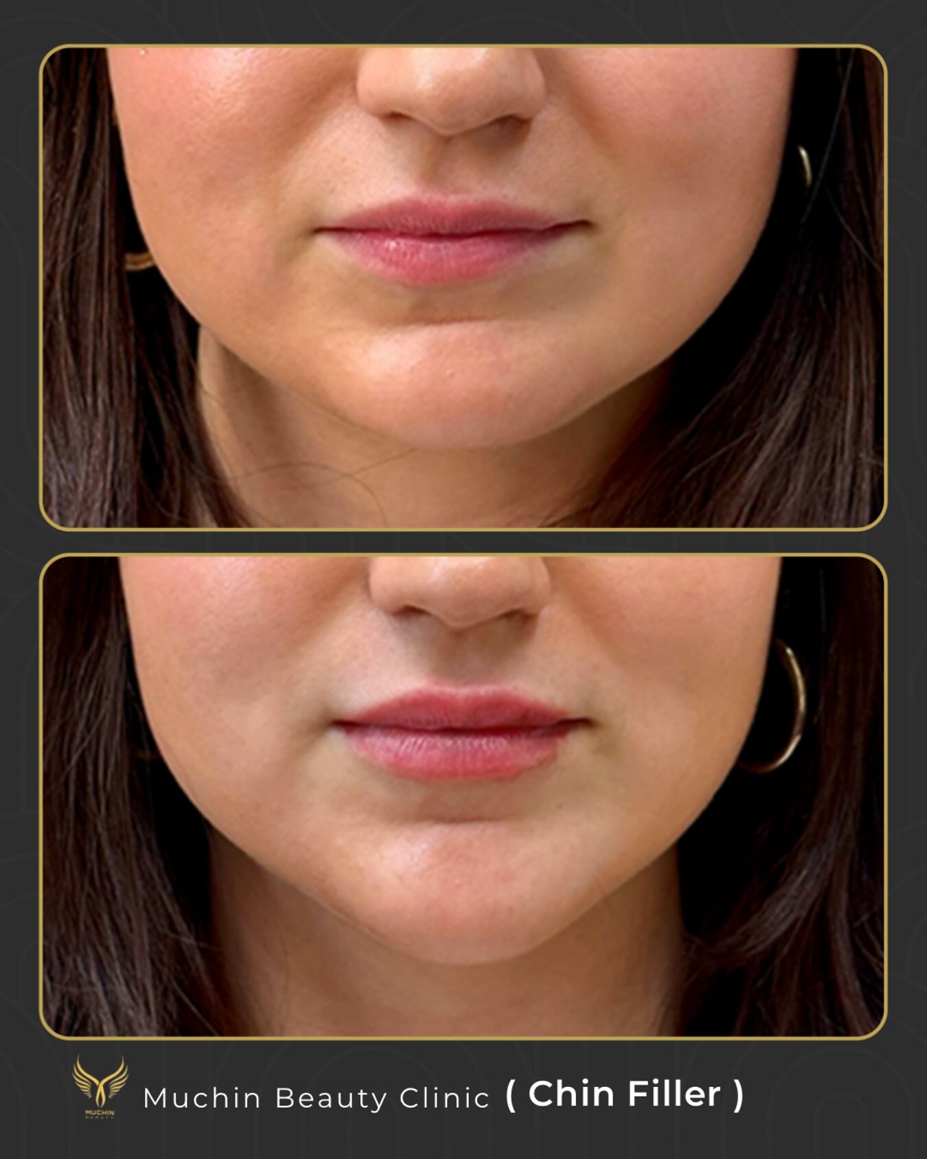 Before & After
