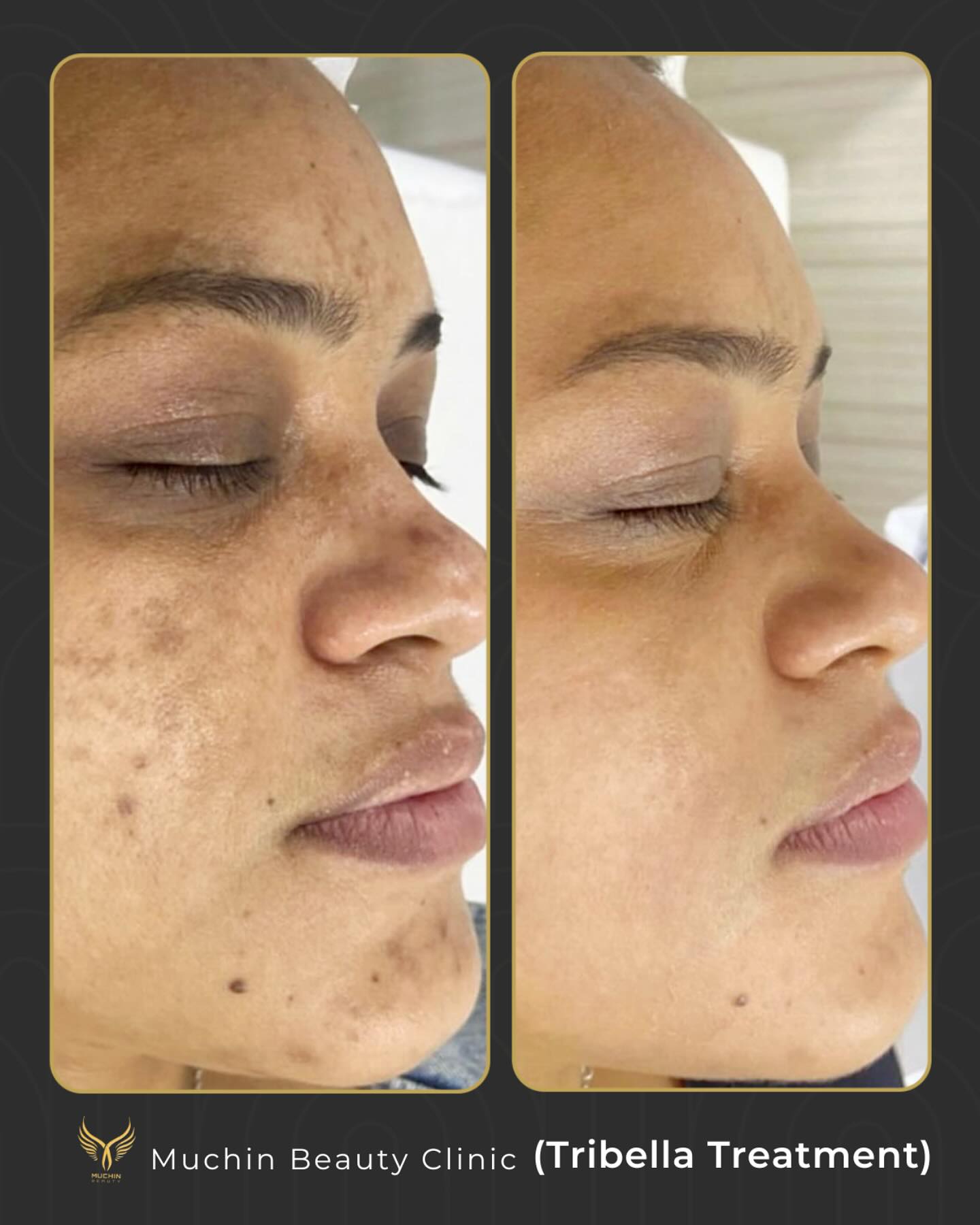 Before & After