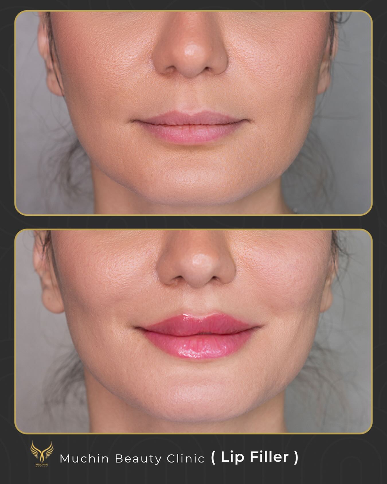 Before & After