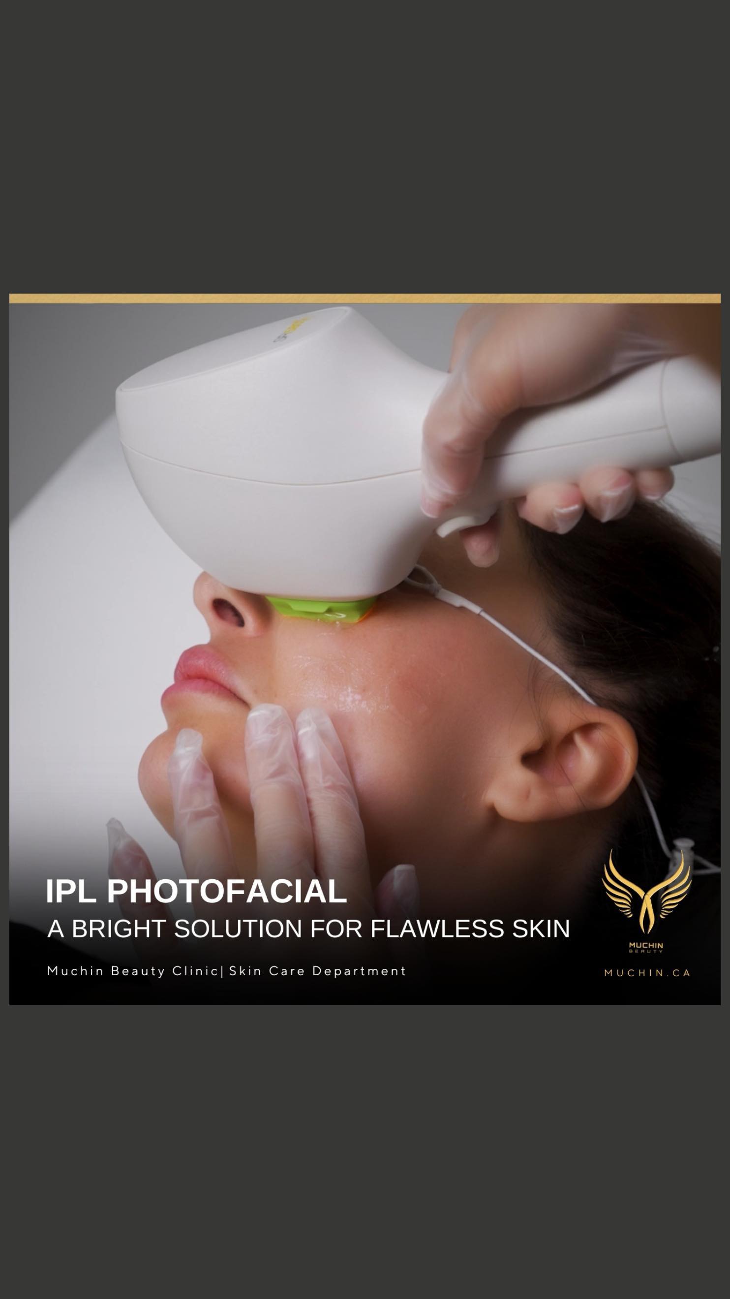 Muchin Beauty — IPL & RF