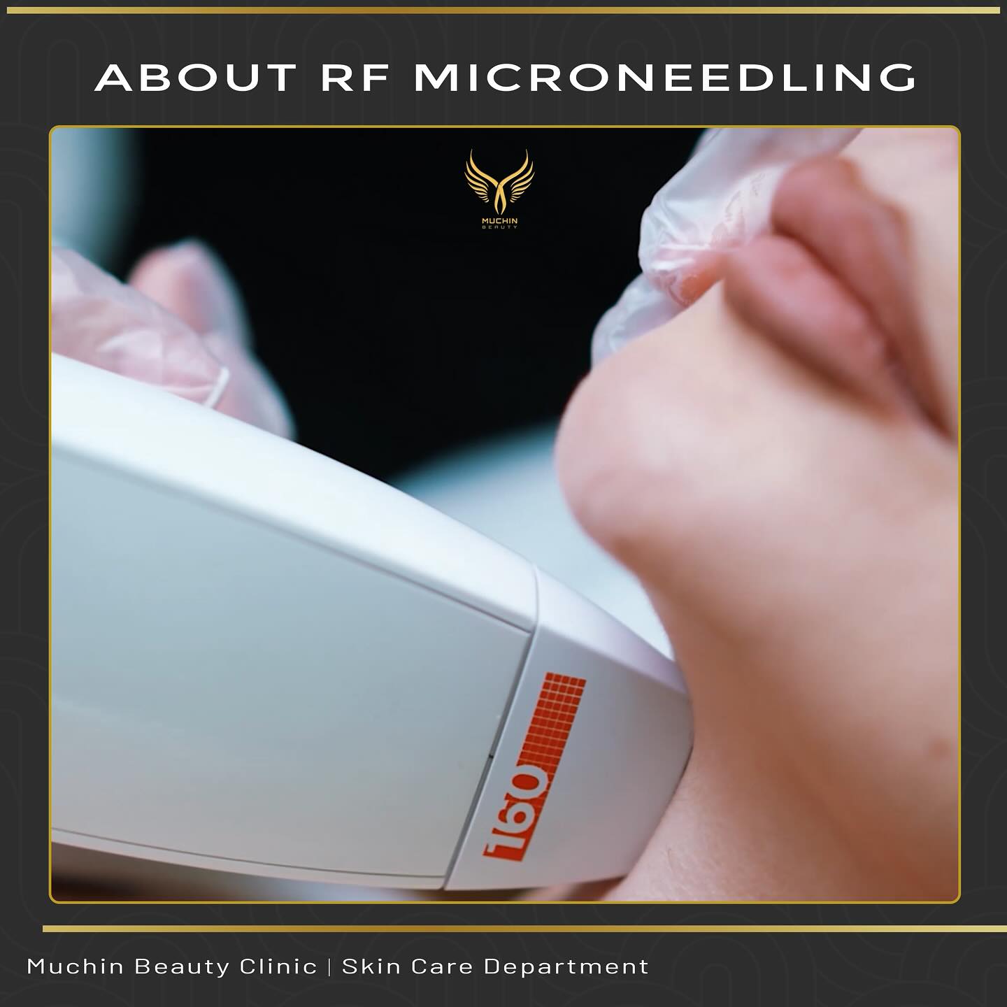 Muchin Beauty — IPL & RF