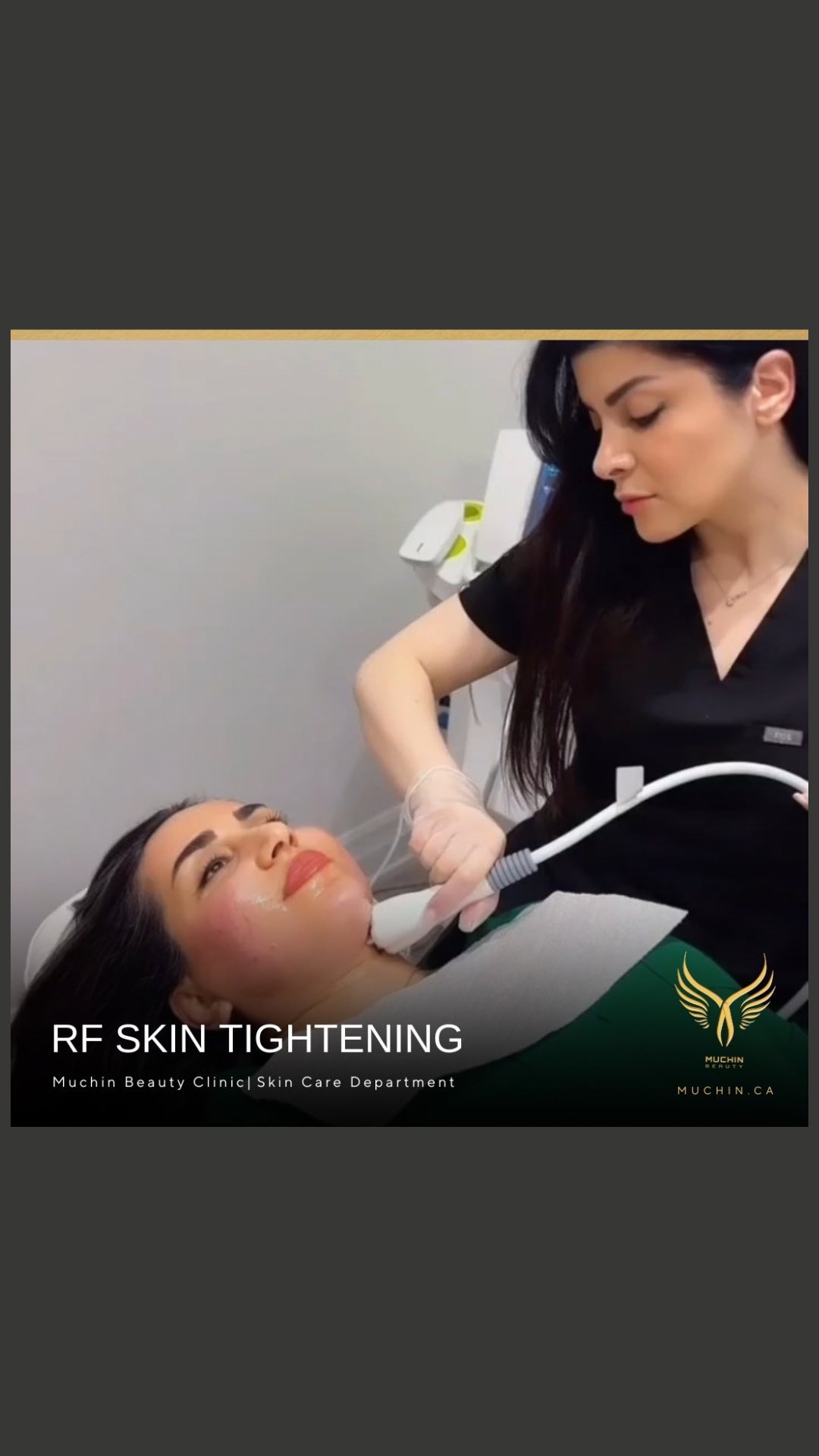 Muchin Beauty — IPL & RF