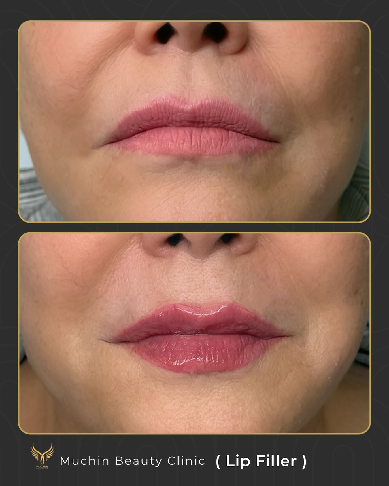 Before & After