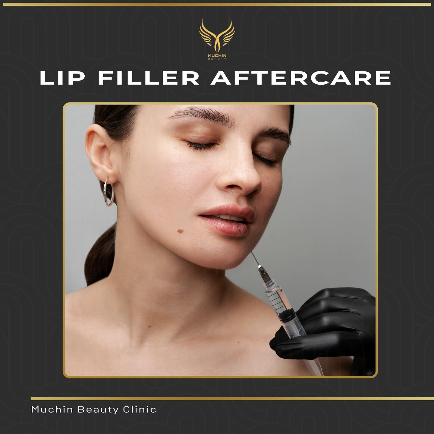 Muchin Beauty — Cosmetic Injection