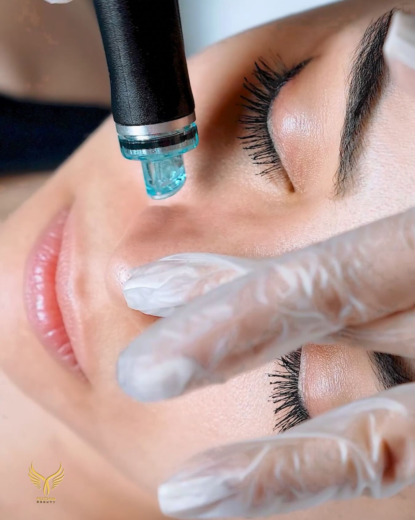 Muchin Beauty — Hydrafacial