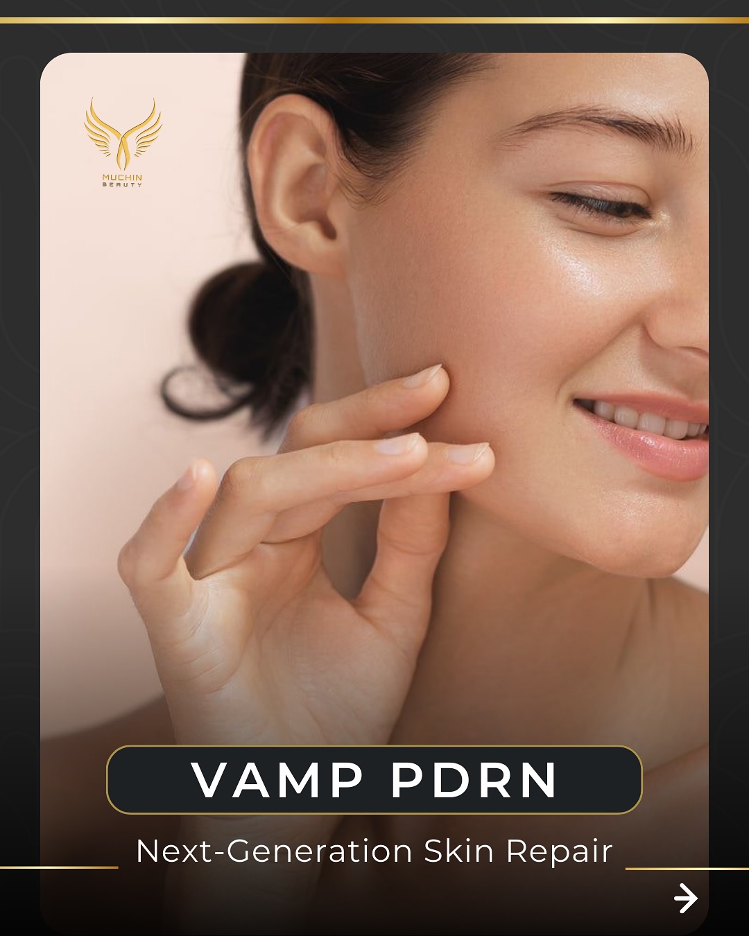 Muchin Beauty — Cosmetic Injection