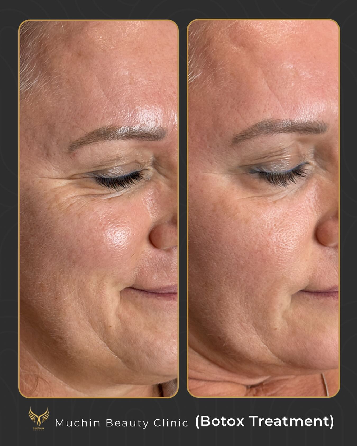 Before & After
