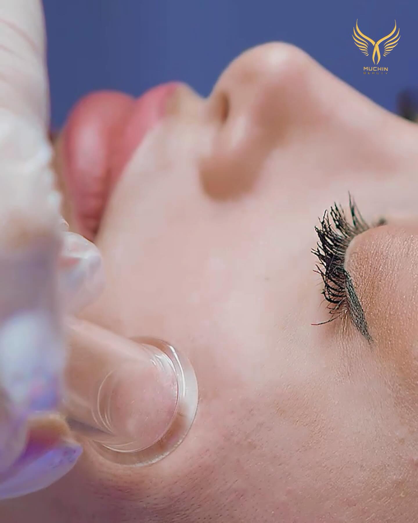 Muchin Beauty — Hydrafacial
