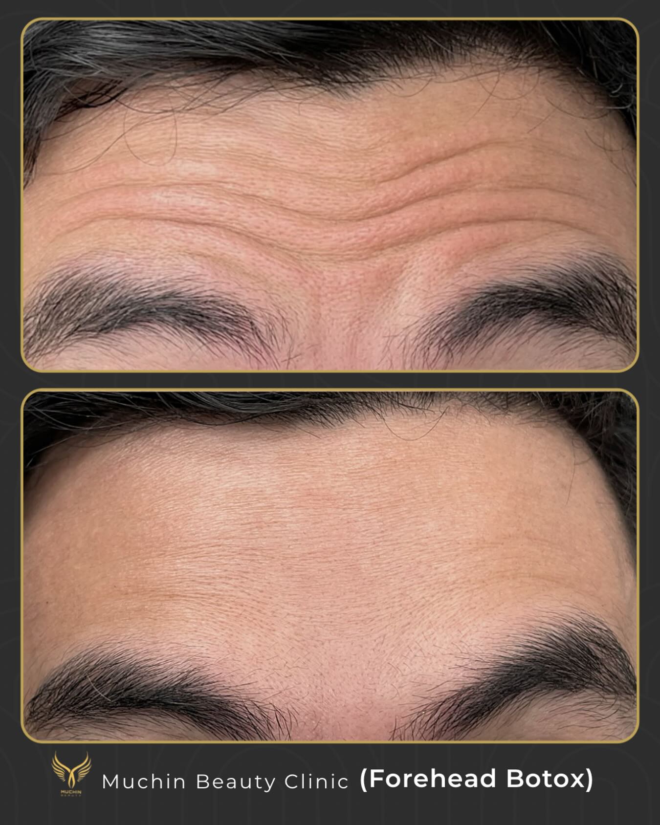 Before & After