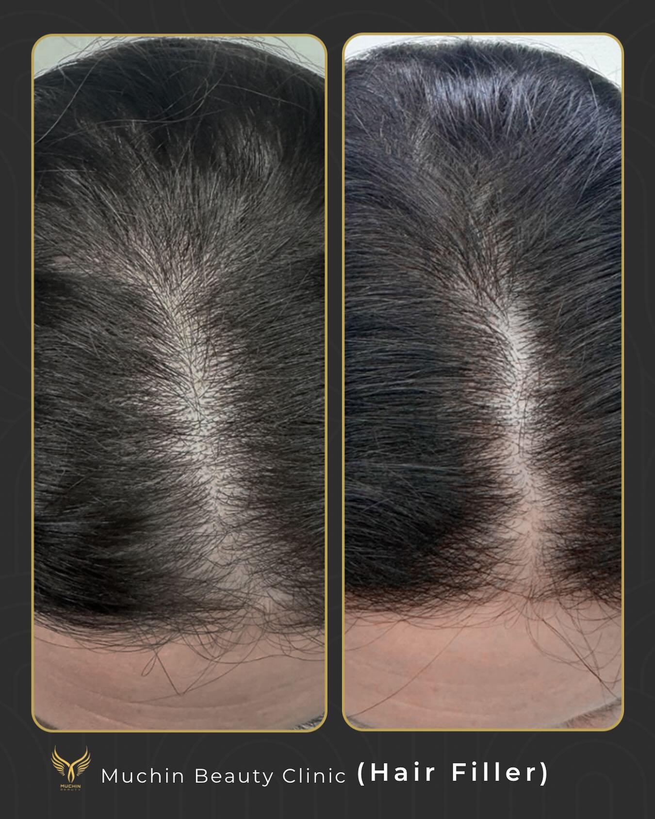 Muchin Beauty — Japanese Head Spa