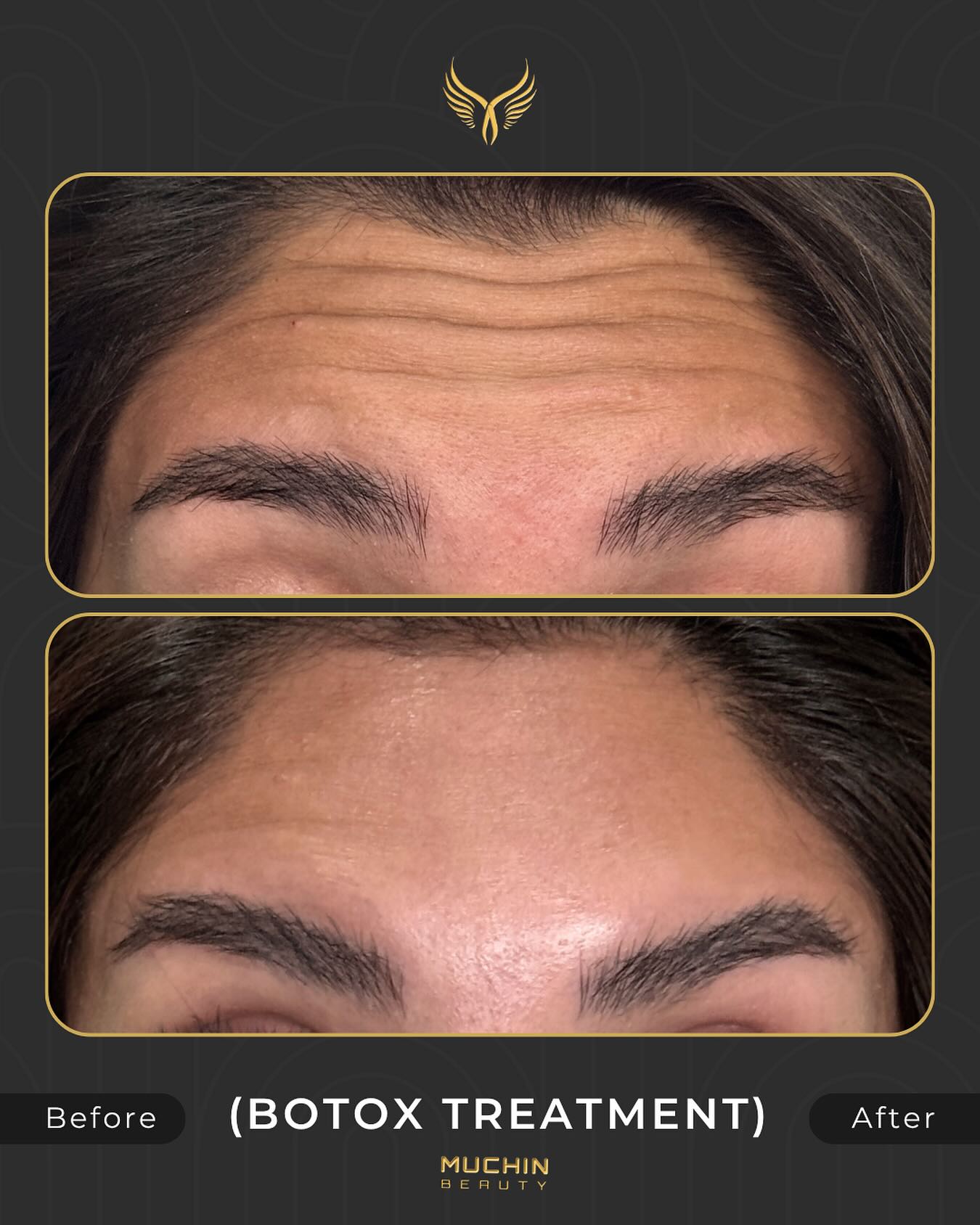 Before & After