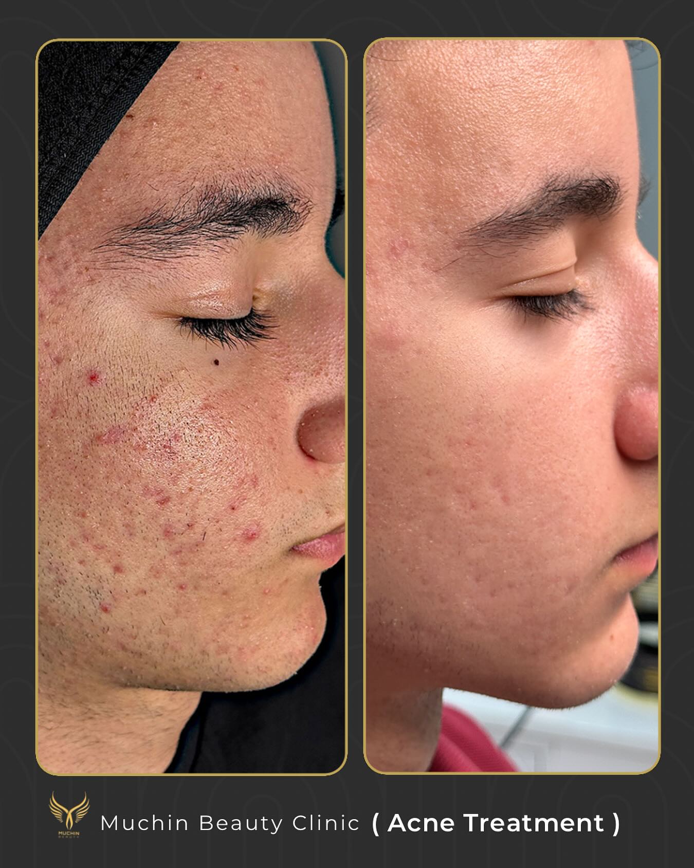 Before & After