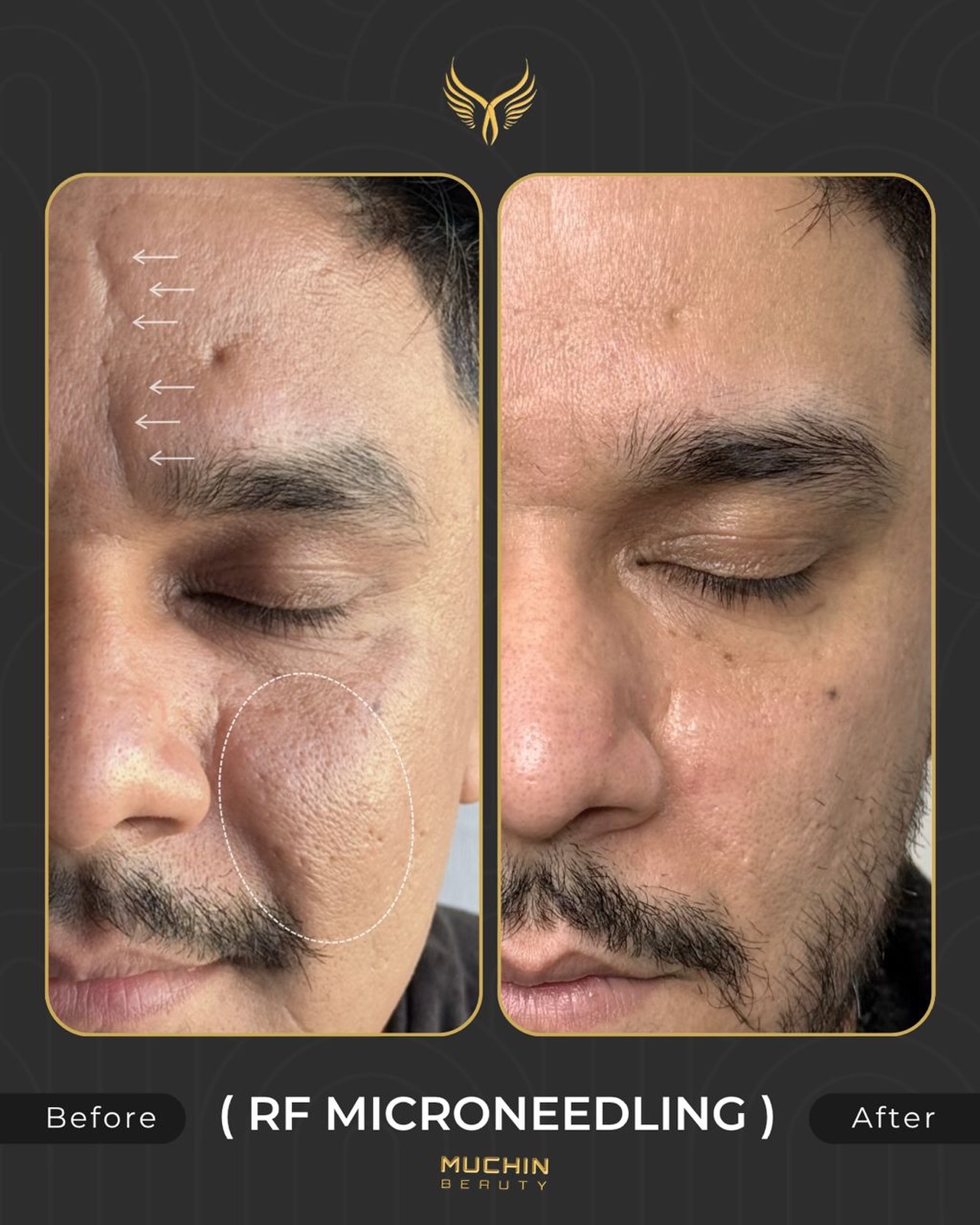 Before & After
