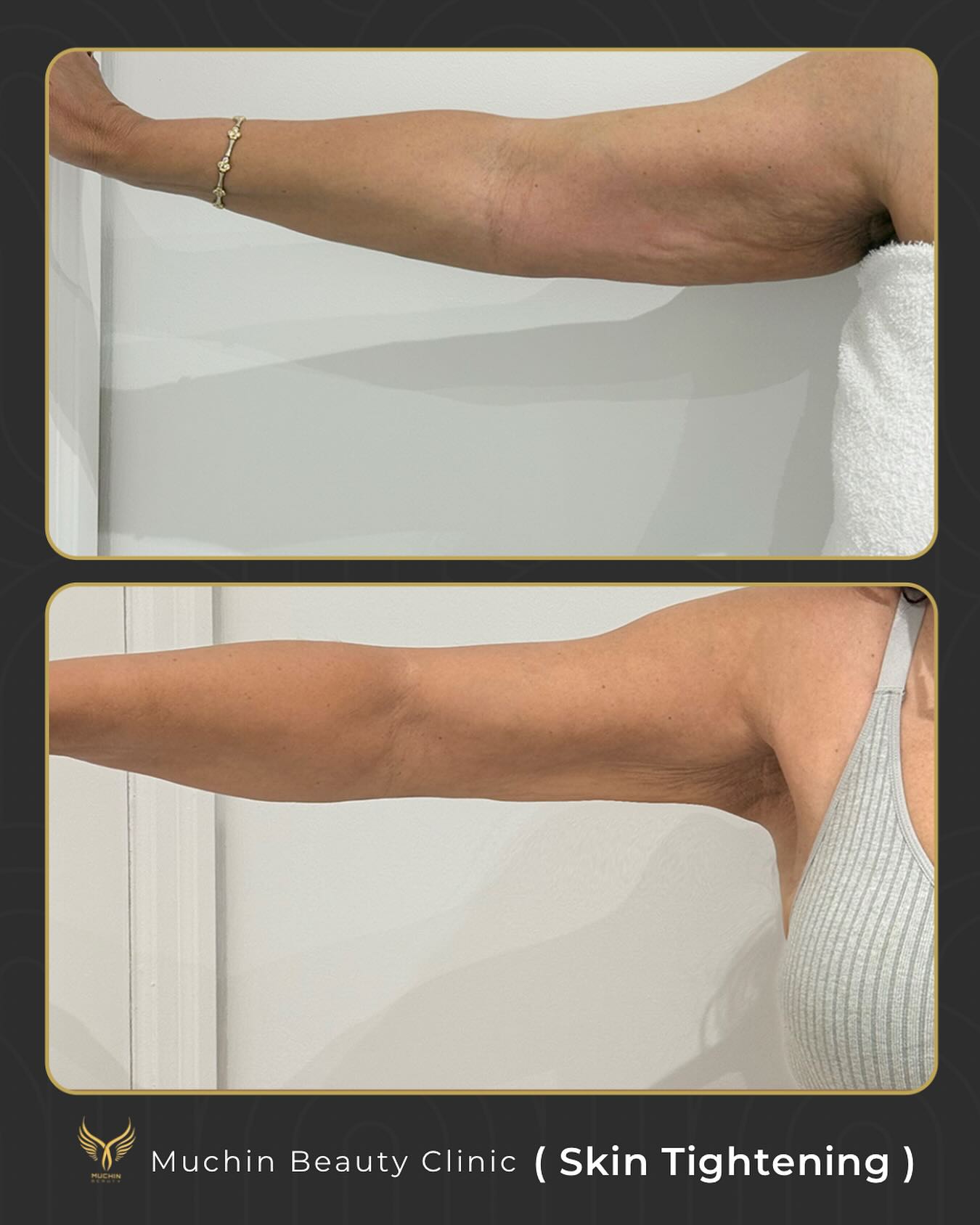 Before & After