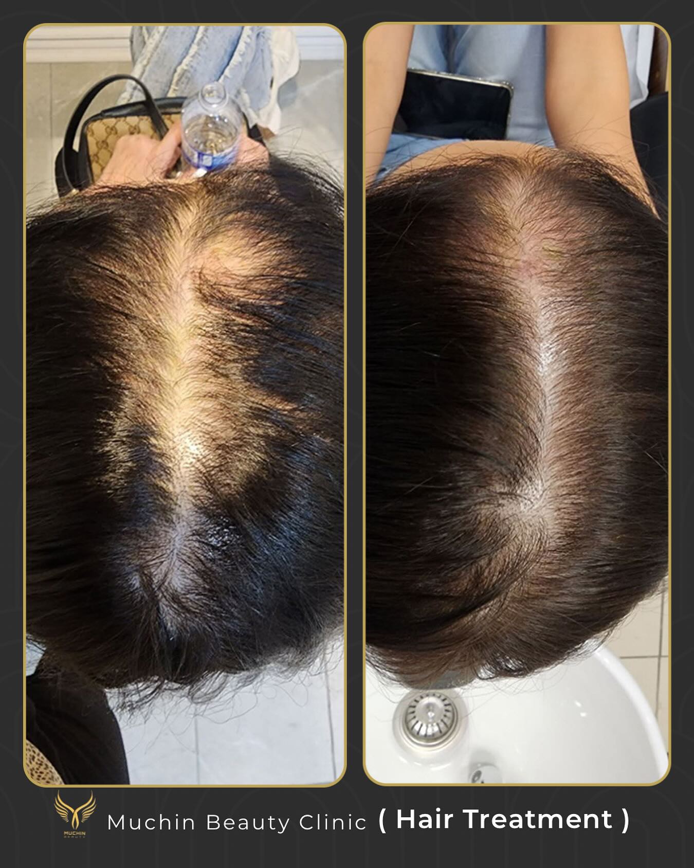 Muchin Beauty — Japanese Head Spa