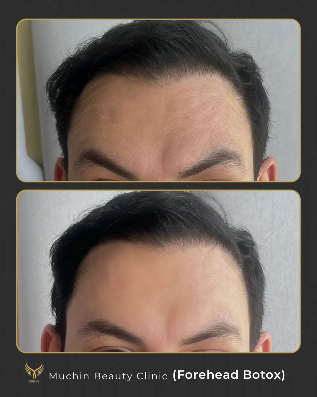 Before & After