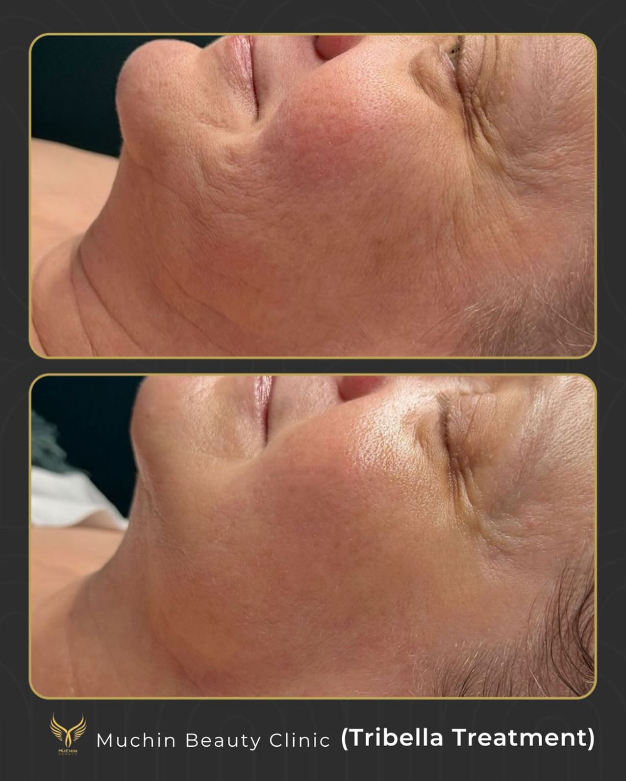 Before & After