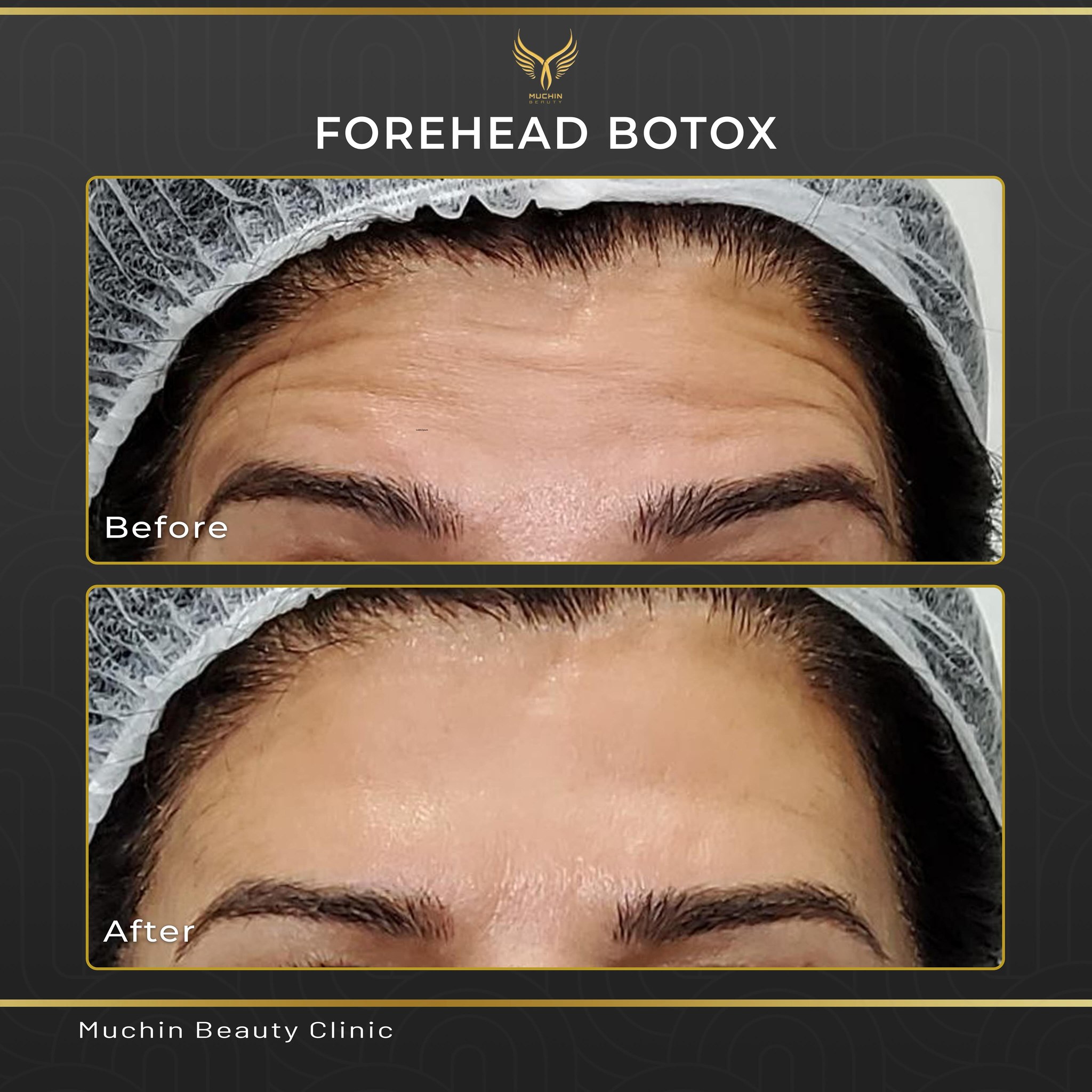 Before & After