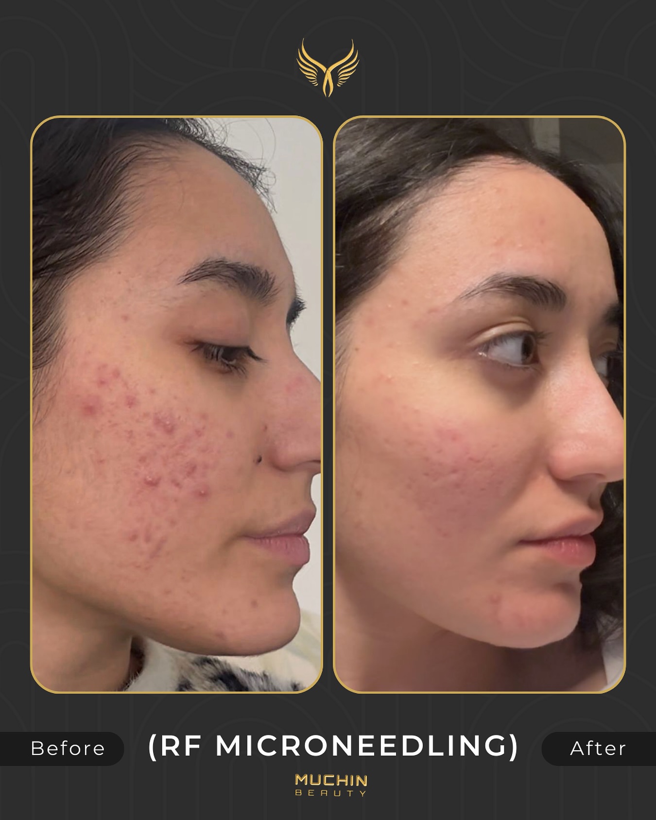 Before & After