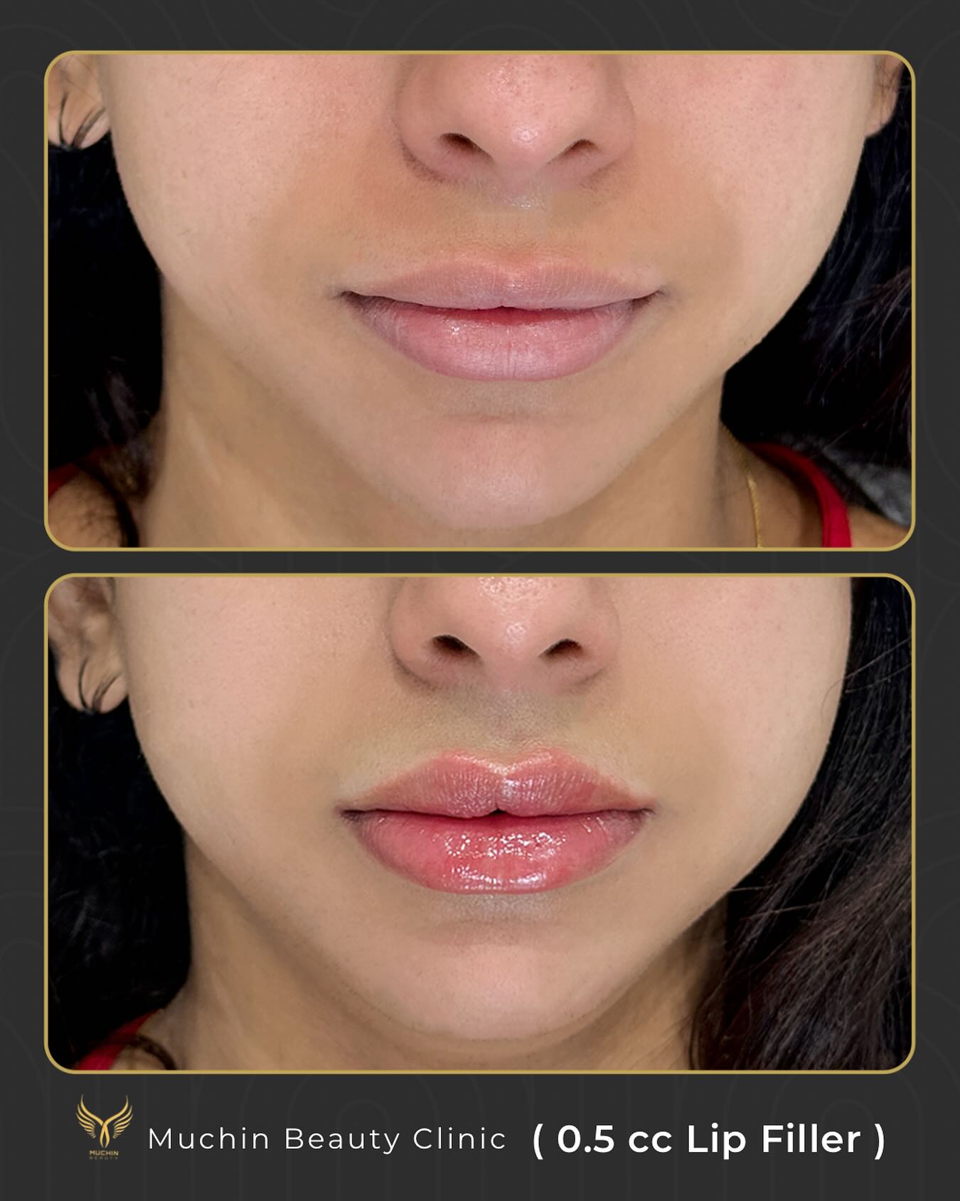 Before & After