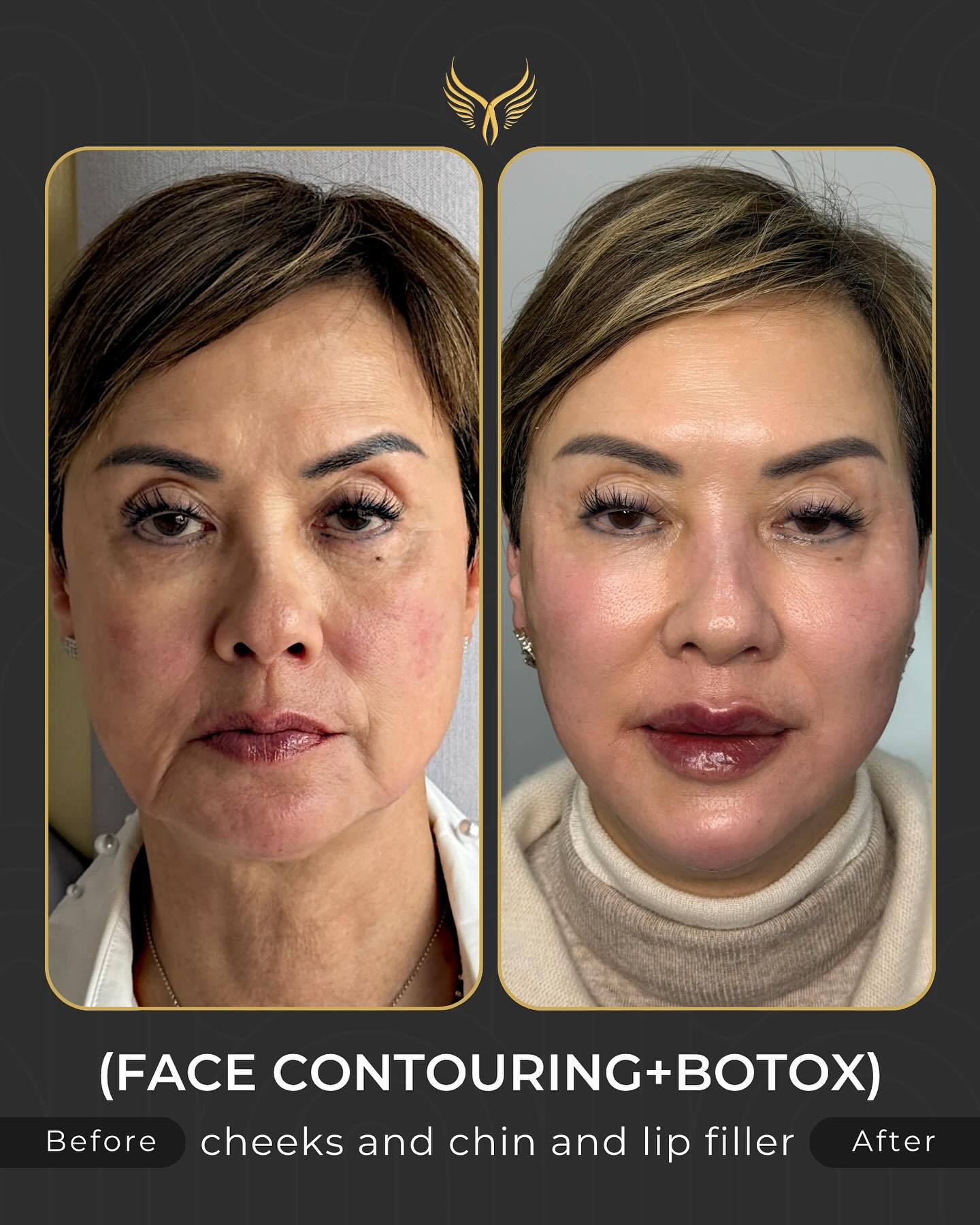 Before & After